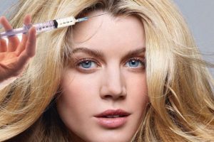 Botox Treatment for Scalp Sweating